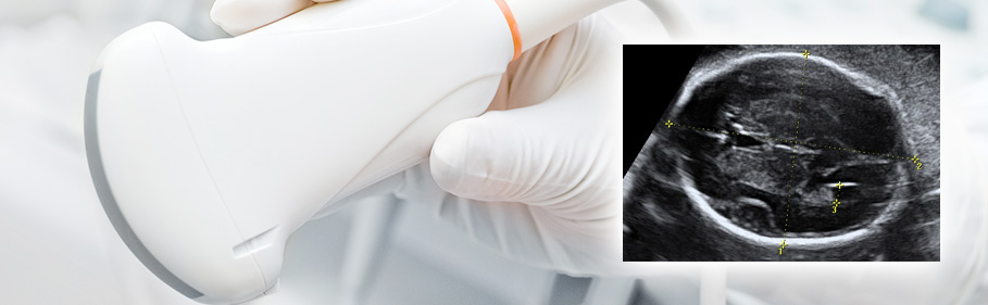ct scan while pregnant second trimester