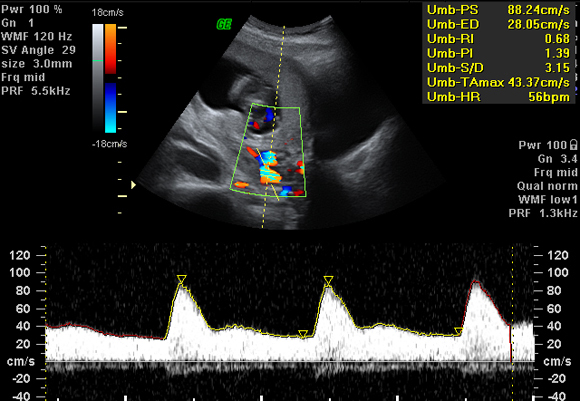 uterine