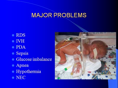 Steroid preterm