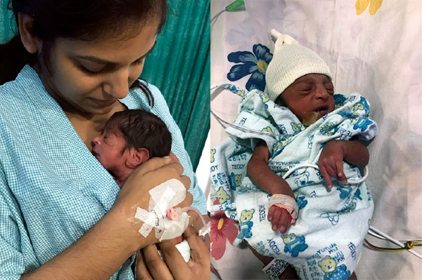 prematurity-blog-apollo-centre-for-fetal-medicine-delhi